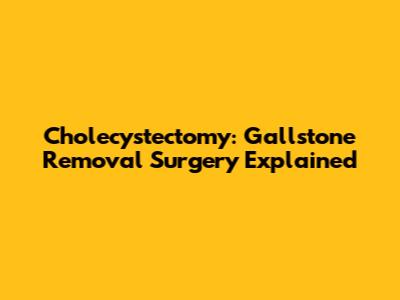 Cholecystectomy: Gallstone Removal Surgery Explained