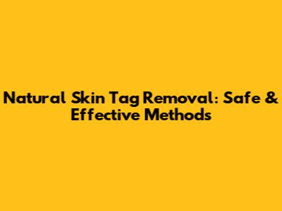 Natural Skin Tag Removal: Safe & Effective Methods