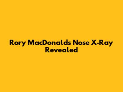 Rory MacDonald's Nose X-Ray Revealed