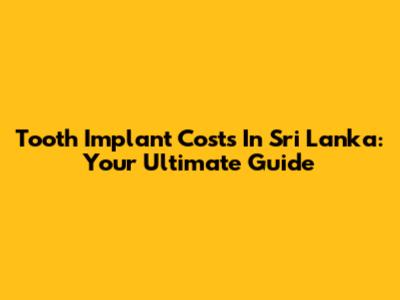 Tooth Implant Costs In Sri Lanka: Your Ultimate Guide